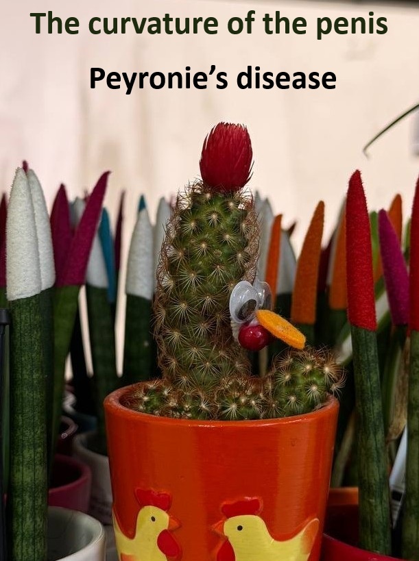 Penile Curvature